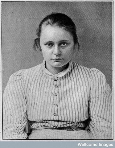 'A feeble-minded girl of unstable mental equilibrium; impulsive and deceitful.' From A.F. Tredgold, Mental Deficiency (Amentia) London: Bailliere, Tindall and Cox, 1929. People were increasingly identified as feeble-minded or morally or mentally deficient and seen as a threat to the 'Good Society'.